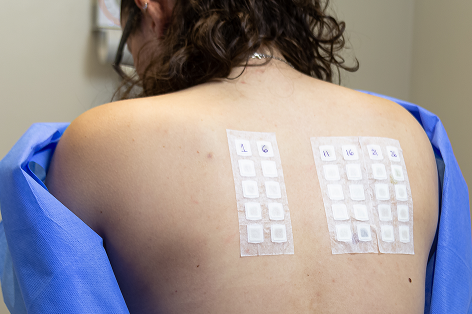 skin-allergy-reaction-person-s-back-1